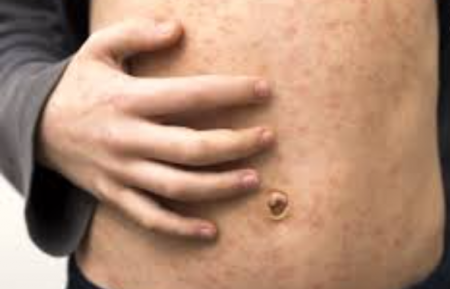 Улаанбурхан өвдсөн биеийн байдал нь хүнд ГУРВАН хүн эмчлүүлж байна